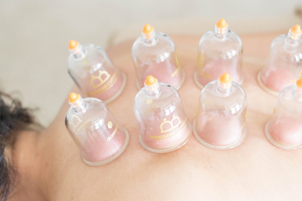 what is cupping therapy massage